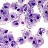 ガン細胞に変化する寄生虫を発見…米国の生物学者ら