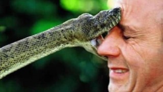 アメリカでガラガラヘビに噛まれた場合の治療請求書がヤバい…高すぎるアメリカの医療費