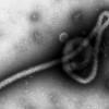 エボラウイルスを体内に注入するボランティア報酬額