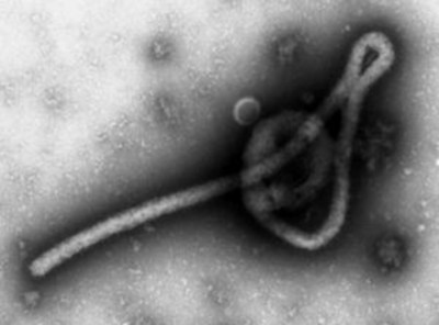 エボラウイルスを体内に注入するボランティア報酬額