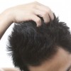 ◆天皇の理髪師◆が教える『薄毛予防法』が説得力ありすぎｗｗｗｗｗｗｗｗ