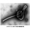 【すげえ不安…】厚労省『エボラウイルス』初の輸入検討