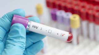 【医療】ウイルス排除に成功『エイズ完治』につながる発見