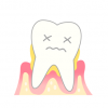 【体験談】歯周病で全部の歯を失って１年が経つんだが…