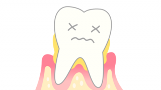 【体験談】歯周病で全部の歯を失って１年が経つんだが…