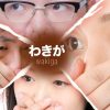 【画像】ワキガの原因である『アポクリン腺』がこちら →