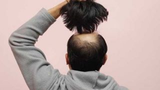 【動画】薄毛男性さん、『カツラを被るだけ』でイケメンに変わってしまうｗｗｗｗ